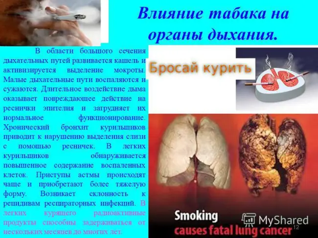Лечение бронхита курильщика